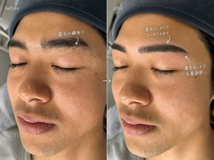 ロコ(RoKo)の写真