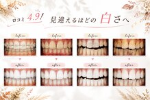 ホワイトニングショップ 府中店