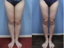 エピア 西尾店(Epia)/炭酸リンパマッサージ