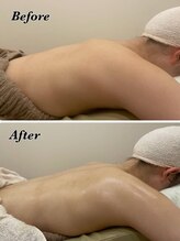 メナードフェイシャルサロン 片町店/背中美人へ