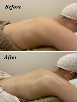 メナードフェイシャルサロン 片町店/背中美人へ