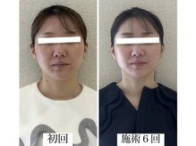 ラボーテヴェリテ(La Beaute Verite)/【お客様施術例】