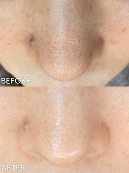 ビアンカ/お客様のお声