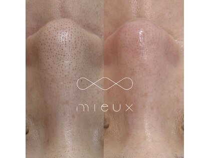 ミュー 栄本店(mieux)の写真