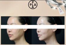 トータルビューティ つぼみ