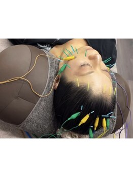 ホウレイ線・たるみ改善！予防ケア