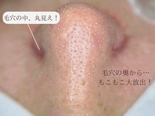 サロン ムスブ(salon MUSUBU)の雰囲気（ ◇毛穴洗浄メニューが大人気◇）