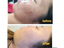 ココンフワット(Coconfouato)の雰囲気（毛穴レス・アクアダーマ肌質改善！ニキビ、ニキビ後、ハリ◎）