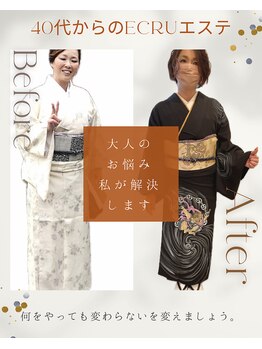 エクルビューティーツー(ECRU Beauty 2)/40代以上の痩身
