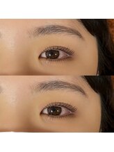 ラグーン(Lagoon)/目元ぱっちり