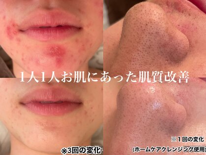 リラ(Lilas)の写真