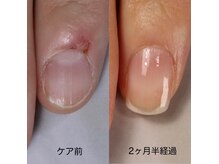 美爪へ！お悩みおさらば！