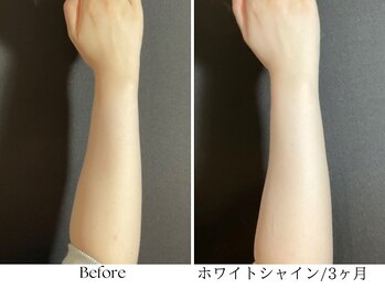 ビボーラ(BEBEAURA)/ホワイトシャイで透明感アップ☆