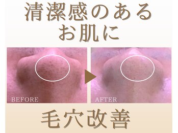 フェイシャルプロ 大阪京橋