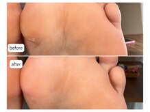 カシェット(Cachette)/40代女性◎足裏角質ケア90分