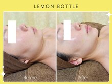 シロカネ 光の森店(SHIROKANE)/レモンボトル☆