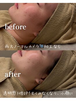 紬/before・after