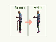 【痩身/ダイエット/整体/骨盤矯正】専門サロン アテオス/80代　腰痛・足の痺れ・ふらつき