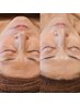 【理想のマイナス肌へ】シワたるみくすみハリ艶UP本格エイジングケア¥13,750