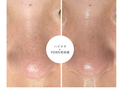 ベル(Belle)の写真
