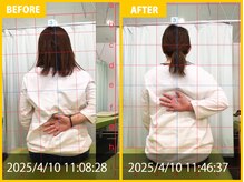 整体院 元 宇城松橋店/首や肩の痛み解消