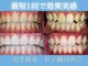 リ ホワイト(Re.White)の写真