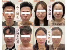 ビーキュート 姫路店(BE-CUTE)の雰囲気（エラ矯正や浮腫み矯正し、美しい小顔に導きます☆韓国式コルギ）
