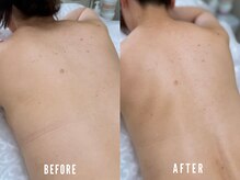 ビーグラム(B.GLAM)/シュガーリング／うなじ＋背中