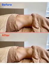 ソルレ 宮崎店(SOLURe)/くびれが爆誕!!宮崎 整体腸もみ