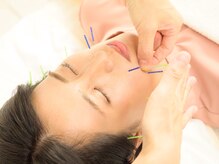 ハリ ヴァカンス(Hari Vacances)/オーダーメイド式美容鍼