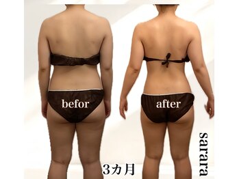 ナチュラル ビューティー スタイル さらさ(Natural Beauty Style)/ブライダル痩身3カ月後