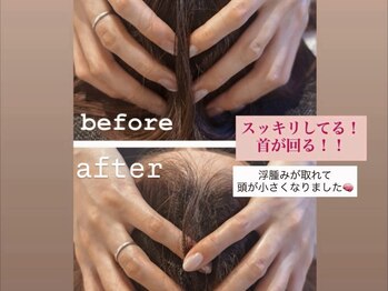 梨の木サロン/ドライヘッド+ブレインリンパ