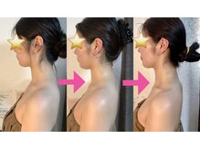 イーリス(i-ris)/ブライダルエステで薄い背中に◎