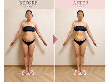 リンパケア専門サロン 銀座店/ダイエットコースのBefore/After