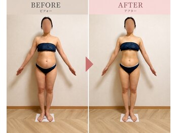 リンパケア専門サロン 銀座店/ダイエットコースのBefore/After