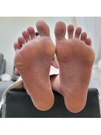 フットケア★足裏カッチカチ