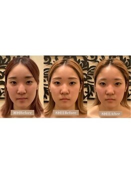 アジール 長岡リバーサイド千秋店(agir)/Before/After画像
