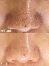 ビアンカ/お客様のお声