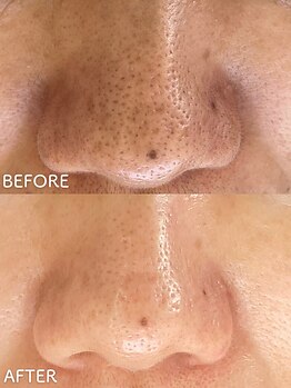 ビアンカ/お客様のお声