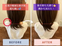 蓮子堂鍼灸整体院/左右の肩の高さが違うを改善♪