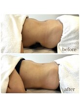 ブルーム(bluem)/ぽっこりお腹がスッキ！