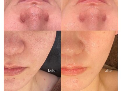 エノアビューティー(ENOA beauty)の写真