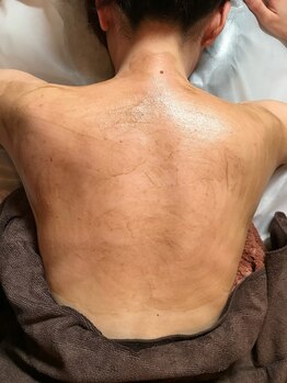 メイクアップスタジオ ウィッシュ(Make up Studio Wish!)の写真/角質肥厚による毛穴の開き/シワ・ニキビケア/年齢によるたるみケア/フェイスラインUP/美白ケアもお任せ☆