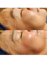 ナニ ヘアーリムーバル ルーム おいらせ緑ヶ丘店(Nani.t hair removal room)/