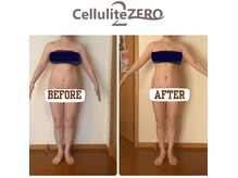 メリッサ(Melissa)