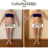 メリッサ(Melissa)