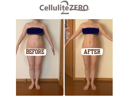 メリッサ(Melissa)の写真