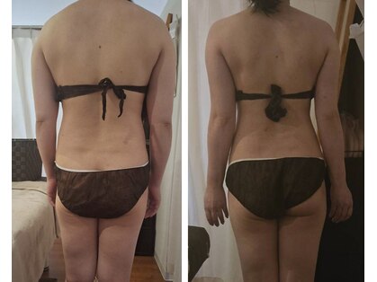 トニートニー(Tony Tony)の写真