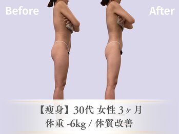 ベルペール(Belle perle)/【痩身/バスト】ハンドセラピス