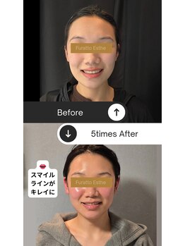 ふらっとエステ/あなたの物語を、もっと美しく
